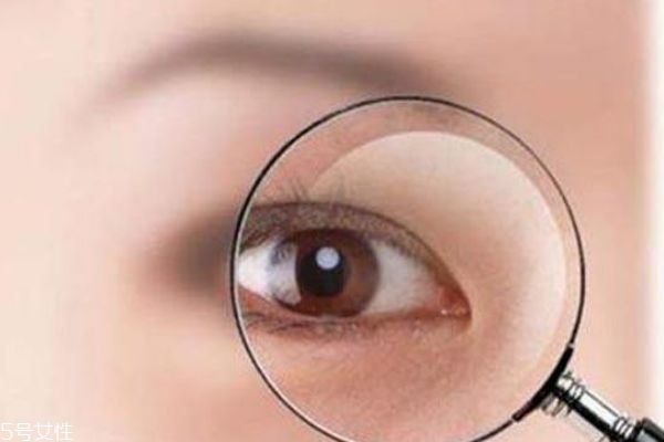 迎風流眼淚是為什么 告別風沙眼 迎風流眼淚是為什么 告別風沙眼