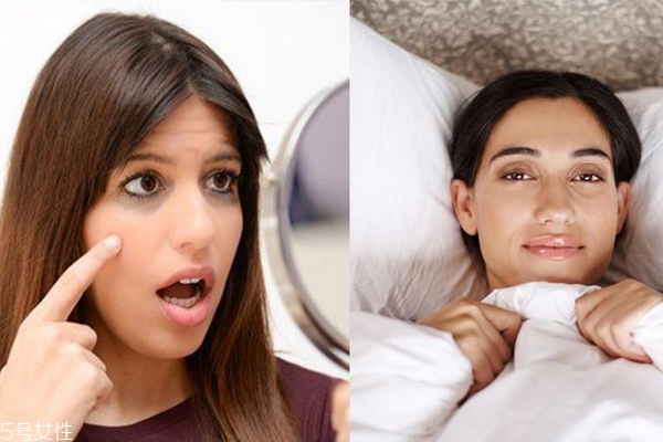 黑眼圈有幾種顏色 3種黑眼圈分辨方法 黑眼圈有幾種顏色 3種黑眼圈分辨方法