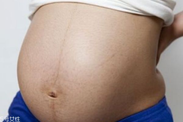 橄欖油可以去妊娠紋嗎 橄欖油孕婦用哪種好 橄欖油可以去妊娠紋嗎 橄欖油孕婦用哪種好