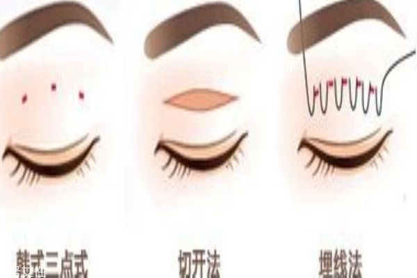 韓式三點(diǎn)和埋線的區(qū)別 你適合做什么樣的