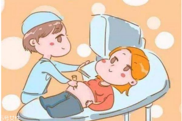 孕婦什么時候做四維彩超最好 孕婦什么時候做四維彩超最好