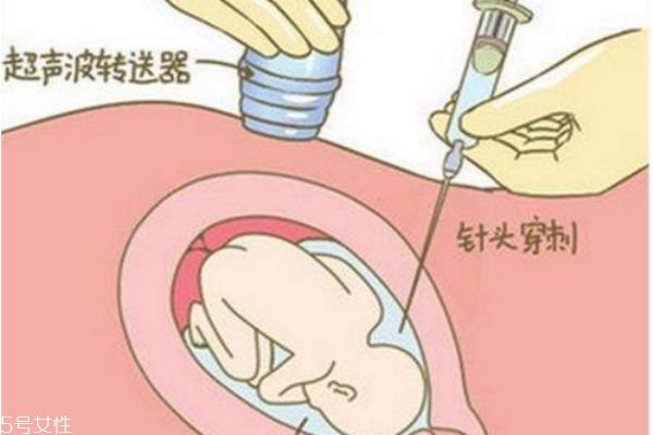 孕婦做羊水穿刺對胎兒有影響嗎 孕婦做羊水穿刺對胎兒有影響嗎