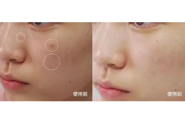 帕妃雯面霜怎么樣 帕妃雯面霜多少錢(qián) 帕妃雯面霜怎么樣 帕妃雯面霜多少錢(qián)