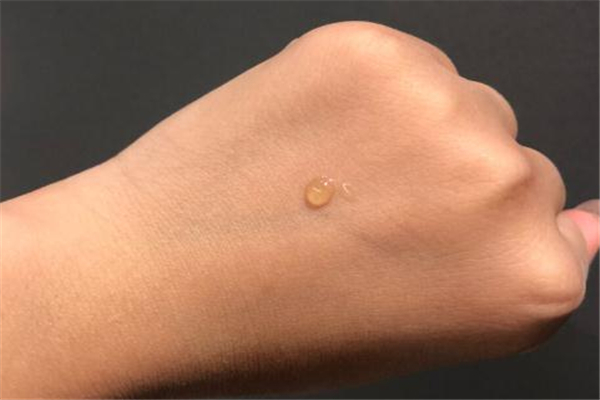 芙清凝膠多少錢一盒 皮膚修復(fù)首選 芙清凝膠多少錢一盒 皮膚修復(fù)首選