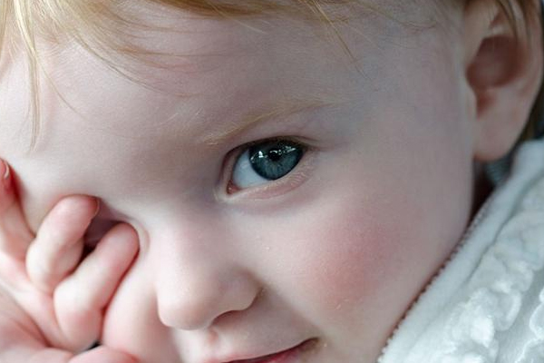 小孩愛(ài)揉眼睛怎么回事 警惕3種病