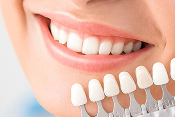 牙齒美白有哪些技術(shù) 4種技術(shù)怎么選擇 牙齒美白有哪些技術(shù) 4種技術(shù)怎么選擇