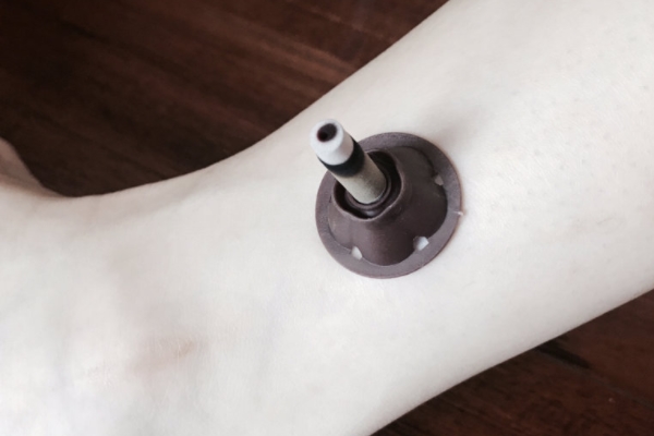 中醫(yī)里的艾灸養(yǎng)生都有哪些功效 中醫(yī)里的艾灸養(yǎng)生都有哪些功效