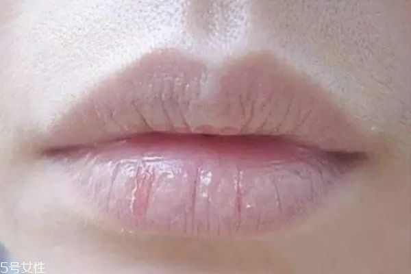 嘴唇為什么干燥 嘴唇干怎么保養(yǎng)