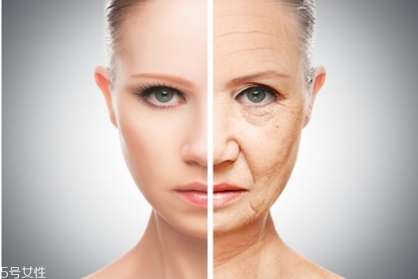 經(jīng)常熬夜長(zhǎng)斑了怎么辦 熬夜長(zhǎng)斑了能去掉嗎