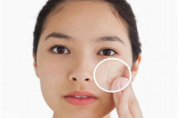 自制皮膚補水小妙招 臉部最簡單的補水方法 自制皮膚補水小妙招 臉部最簡單的補水方法