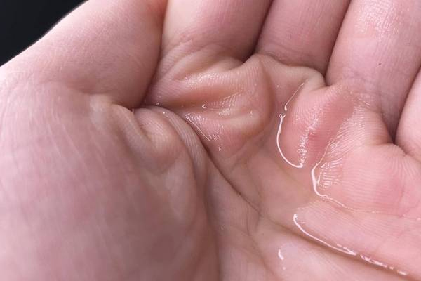 貝德瑪潔膚液有什么用 貝德瑪潔膚液好嗎 貝德瑪潔膚液有什么用 貝德瑪潔膚液好嗎