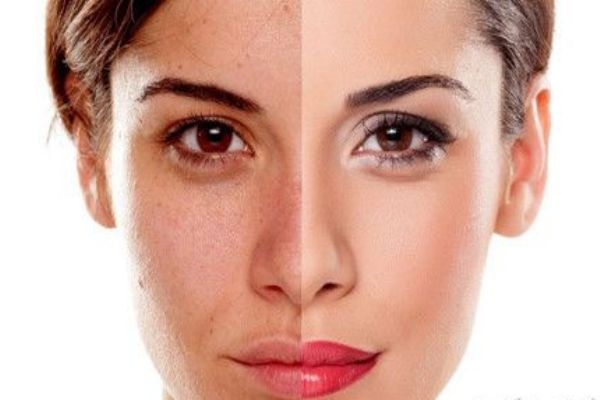 傳明酸精華白天能用嗎 傳明酸需要避光使用嗎 傳明酸精華白天能用嗎 傳明酸需要避光使用嗎