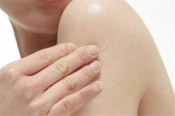 什么是冬季癢 冬季癢預(yù)防之道 什么是冬季癢 冬季癢預(yù)防之道