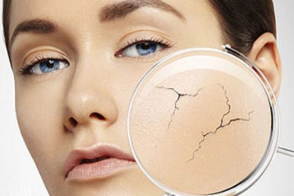 怎么修復(fù)皮膚屏障 換季過敏的原因 怎么修復(fù)皮膚屏障 換季過敏的原因