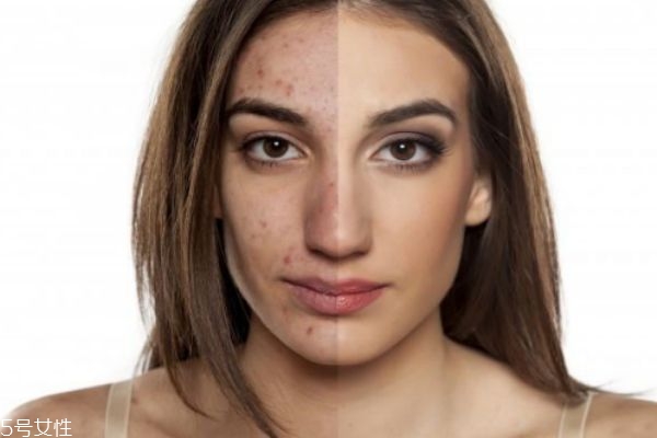 用了精華液還要用霜嗎 教你正確使用步驟 用了精華液還要用霜嗎 教你正確使用步驟