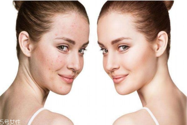 皮膚護(hù)理一次多少錢(qián) 皮膚護(hù)理多久做一次好