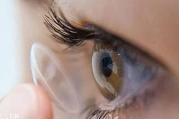 美瞳戴久了眼睛會(huì)怎么樣 美瞳戴久了的危害 美瞳戴久了眼睛會(huì)怎么樣 美瞳戴久了的危害