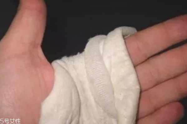 燙傷后的黑印會(huì)消退嗎 需要較長時(shí)間