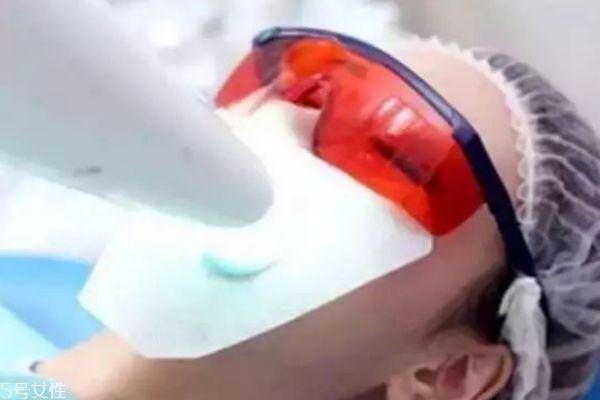 美牙儀傷牙齒嗎 如何正確使用美牙儀 美牙儀傷牙齒嗎 如何正確使用美牙儀