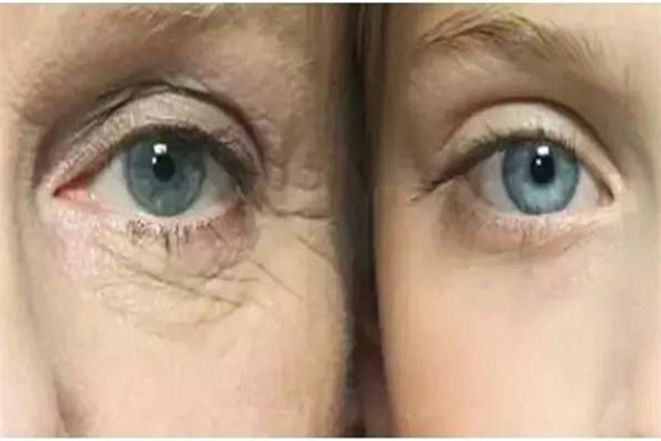 二十歲用什么眼霜比較好 二十歲用眼霜早嗎