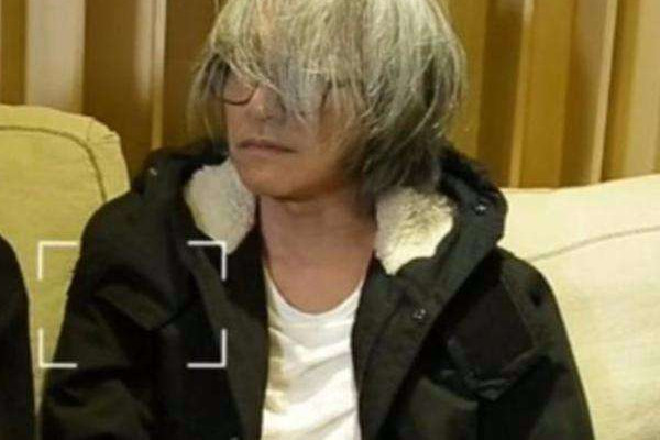 白頭發(fā)可以拔嗎 白頭發(fā)解決方法 白頭發(fā)可以拔嗎 白頭發(fā)解決方法