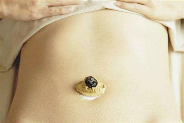 艾灸減肥會反彈嗎 保持健康生活習慣 艾灸減肥會反彈嗎 保持健康生活習慣