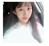 開內(nèi)眼角要多久恢復(fù) 依個人體質(zhì)而定 開內(nèi)眼角要多久恢復(fù) 依個人體質(zhì)而定