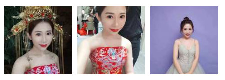 開內(nèi)眼角要多久恢復(fù) 依個人體質(zhì)而定 開內(nèi)眼角要多久恢復(fù) 依個人體質(zhì)而定