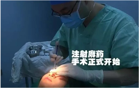 開內(nèi)眼角要多久恢復(fù) 依個人體質(zhì)而定 開內(nèi)眼角要多久恢復(fù) 依個人體質(zhì)而定