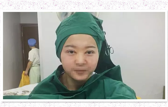 開內(nèi)眼角要多久恢復(fù) 依個人體質(zhì)而定 開內(nèi)眼角要多久恢復(fù) 依個人體質(zhì)而定