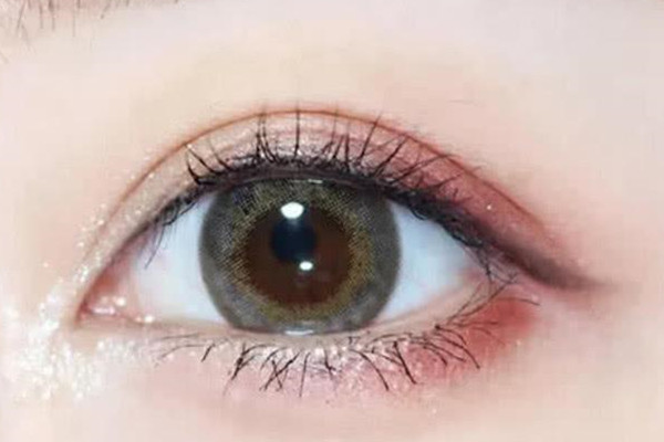 開眼角怎么樣才能不破壞原生美 去贅皮隱形縫合效果好 開眼角怎么樣才能不破壞原生美 去贅皮隱形縫合效果好