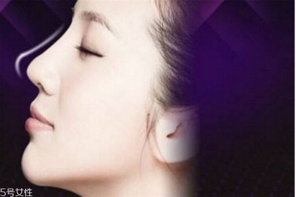線雕鼻多久才自然好看 線雕鼻子適合的人群 線雕鼻多久才自然好看 線雕鼻子適合的人群