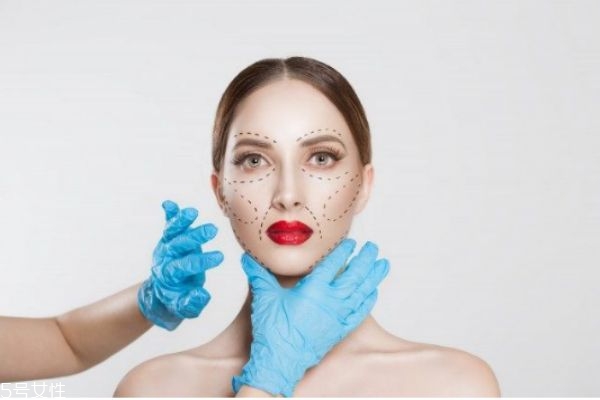 削顴骨危險嗎 顴骨內推多久恢復自然