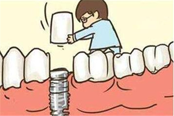 種植牙有什么風險 種植牙的風險大嗎