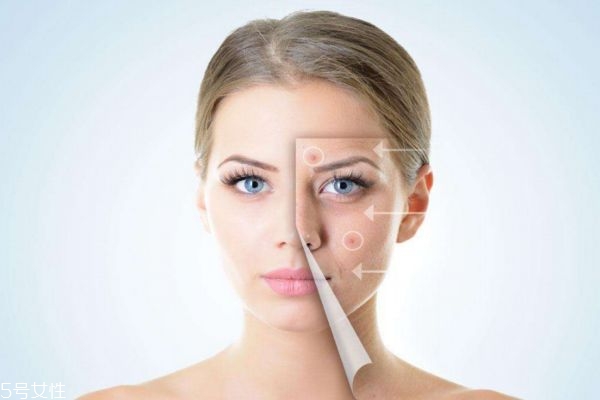 打美白針能去斑嗎 美白針作用是美白 打美白針能去斑嗎 美白針作用是美白