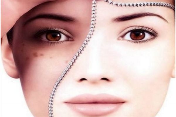 打美白針能去斑嗎 美白針作用是美白 打美白針能去斑嗎 美白針作用是美白