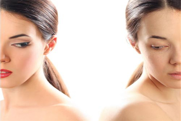 美杜莎雙眼皮多久恢復 美杜莎雙眼皮是什么 美杜莎雙眼皮多久恢復 美杜莎雙眼皮是什么