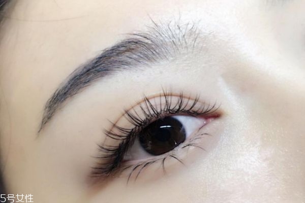 上瞼下垂手術(shù)能保幾年 上瞼提肌縮短術(shù)后遺癥 上瞼下垂手術(shù)能保幾年 上瞼提肌縮短術(shù)后遺癥