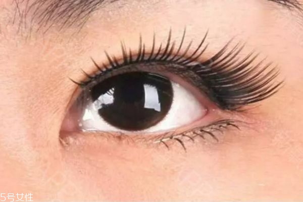 眼瞼下至術(shù)是什么 眼瞼下至術(shù)的手術(shù)原理 眼瞼下至術(shù)是什么 眼瞼下至術(shù)的手術(shù)原理