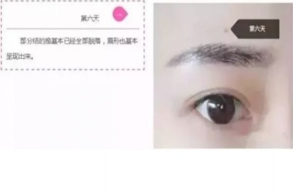紋眉幾天會變細 紋眉七天的變化 紋眉幾天會變細 紋眉七天的變化