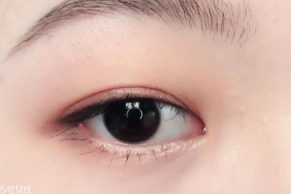 腫眼泡去脂去皮可以不割雙眼皮嗎 腫眼泡適合的雙眼皮 腫眼泡去脂去皮可以不割雙眼皮嗎 腫眼泡適合的雙眼皮