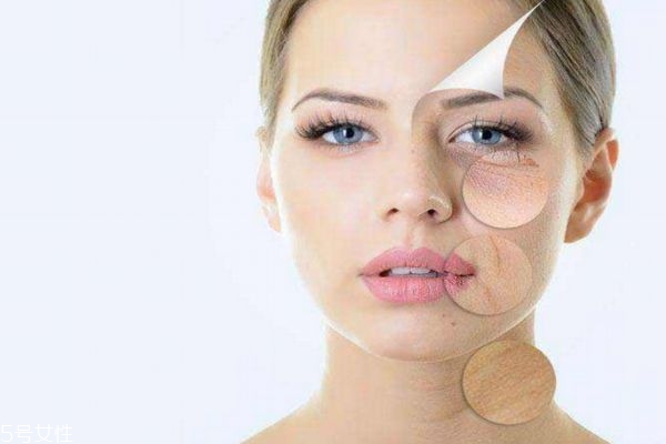 做一次果酸效果明顯嗎 果酸換膚能維持多久 做一次果酸效果明顯嗎 果酸換膚能維持多久