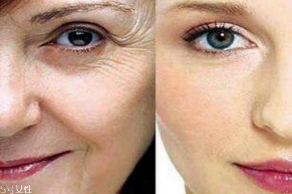 熱瑪吉會(huì)溶脂嗎 熱瑪吉適合范圍 熱瑪吉會(huì)溶脂嗎 熱瑪吉適合范圍