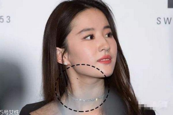 頸紋和胖有關(guān)系嗎 瘦了是不是頸紋就會(huì)沒(méi)