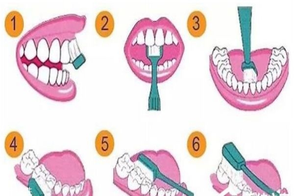 電動牙刷好用嗎 電動牙刷的優(yōu)缺點 電動牙刷好用嗎 電動牙刷的優(yōu)缺點