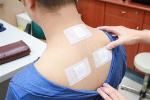 三伏貼在哪里可以買(mǎi)到 三伏貼哪里有賣(mài)