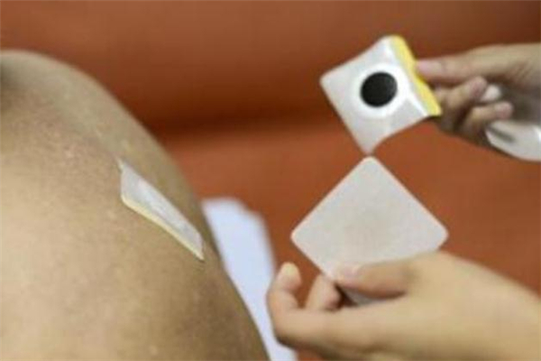 三伏貼在哪里可以買(mǎi)到 三伏貼哪里有賣(mài)