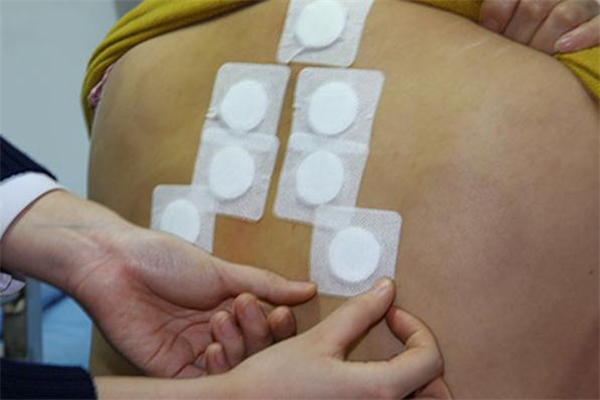 三伏貼每年都要貼嗎 三伏貼每年時(shí)間一樣嗎 三伏貼每年都要貼嗎 三伏貼每年時(shí)間一樣嗎