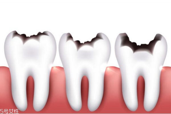 牙結(jié)石清理多少錢 去除牙結(jié)石價格 牙結(jié)石清理多少錢 去除牙結(jié)石價格