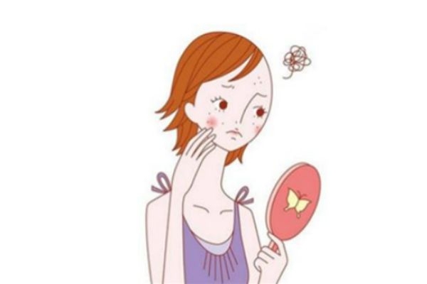 出水痘可以曬太陽嗎 水痘患者的保養(yǎng) 出水痘可以曬太陽嗎 水痘患者的保養(yǎng)